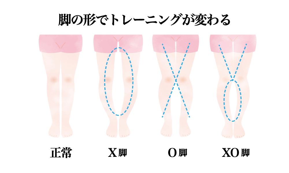 脂肪のつきやすい部位が遺伝子検査で知れる